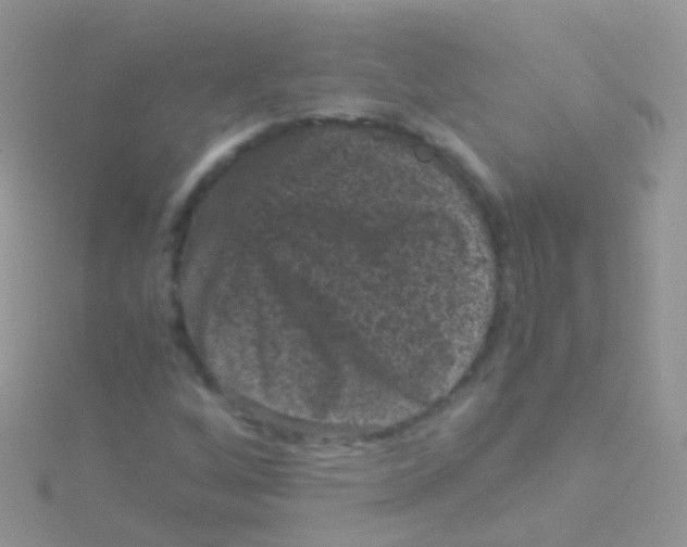 X0000115041256200911231125