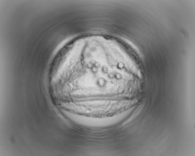 X0000115041325200911231125