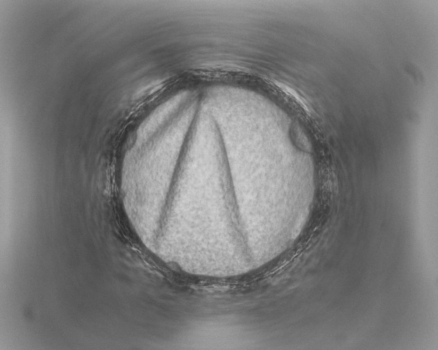 X0000115040965200912071106