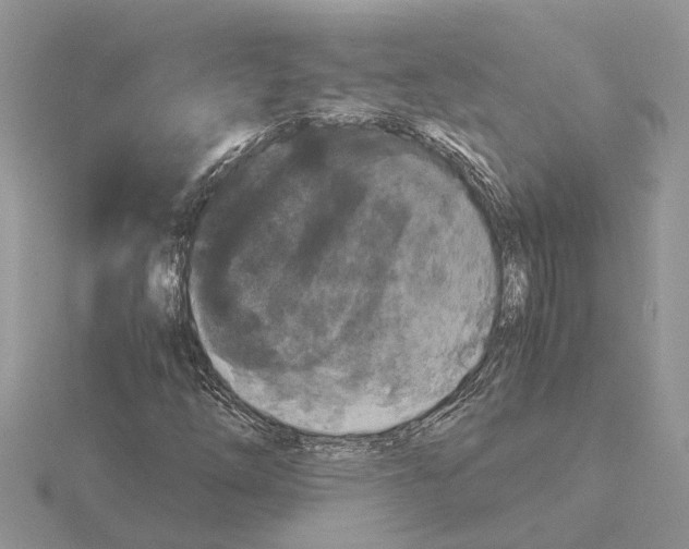 X0000115041254200912071102