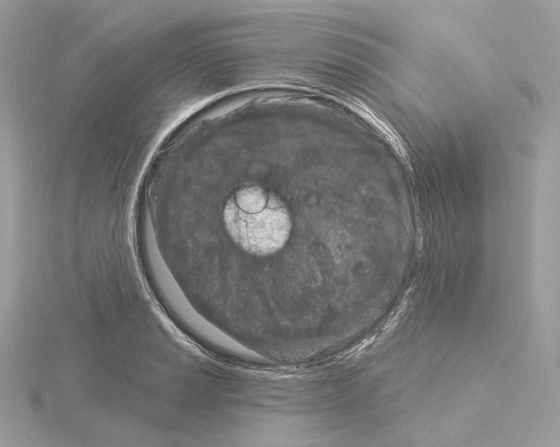 X0000115051037200912071126