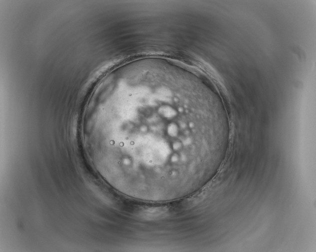 X0000115060155200911091453