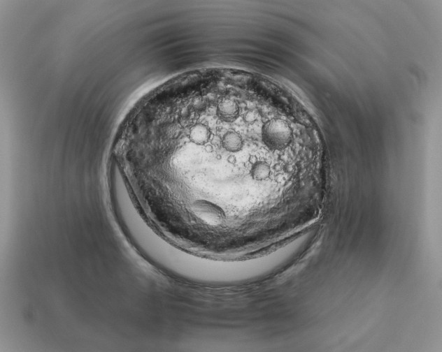 X0000115061133200911091441