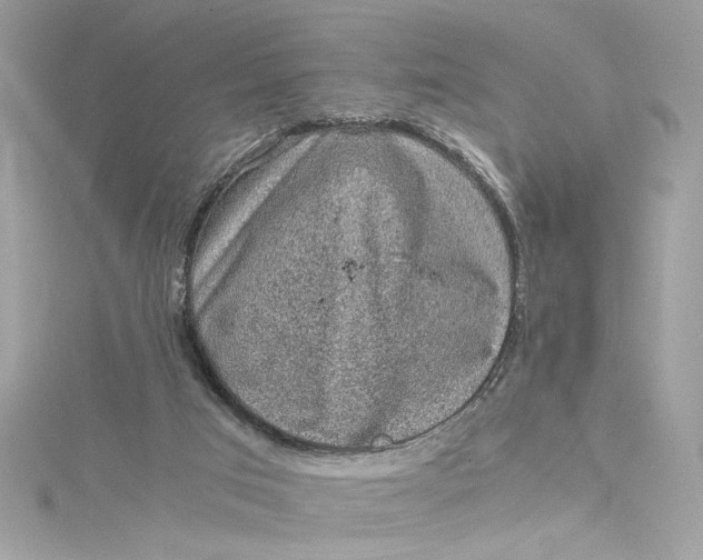 X0000115060017200911161618