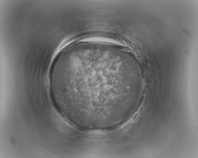 X0000115060198200911161615