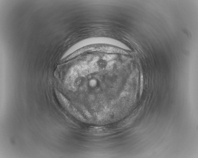 X0000115060277200911161615