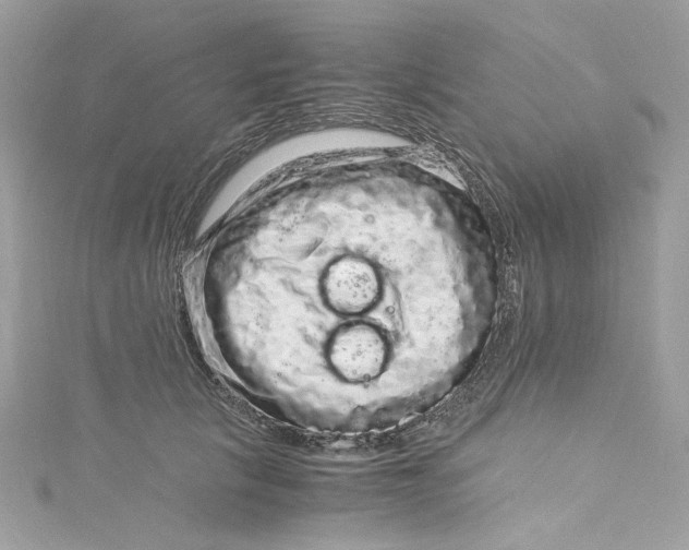 X0000115060657200911161610