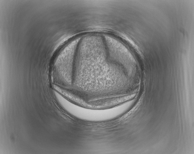 X0000115061259200911161601