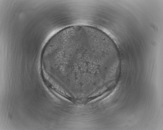 X0000115061469200911161558