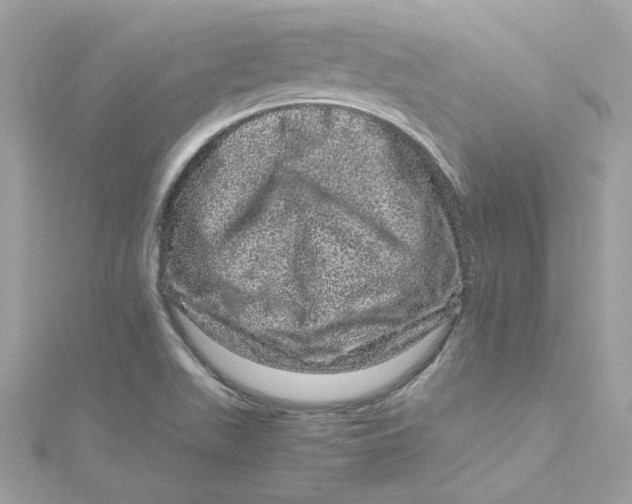 X0000115061511200911161557