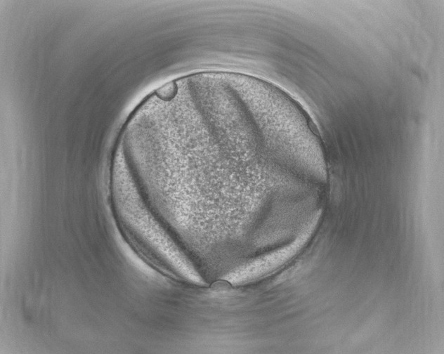 X0000115061531200911161558