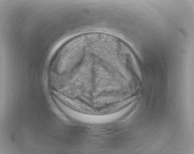 X0000115061511200911231204