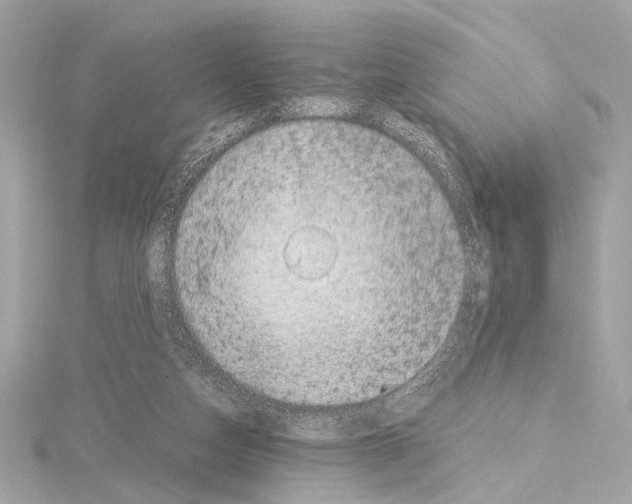 X0000115060162200912071158