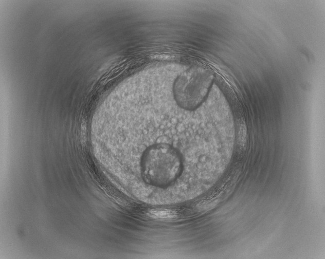 X0000115060557200912071153