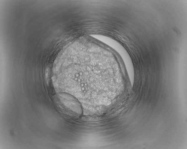 X0000115060670200912071152