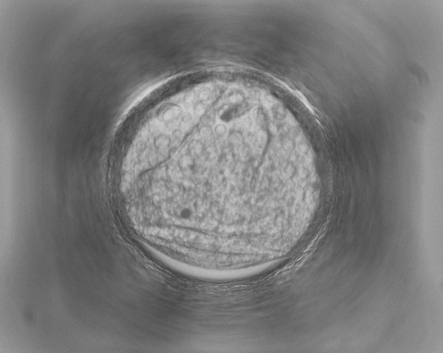 X0000115061311200912071143