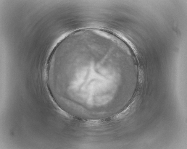 X0000115061477200912071141