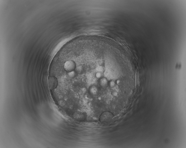 X0000115070147200911171138