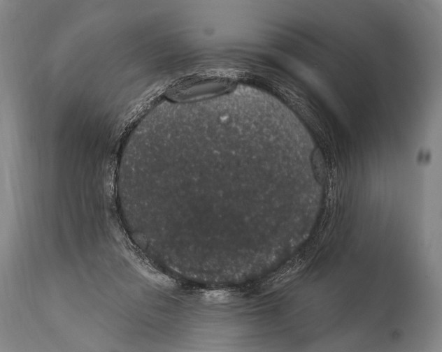 X0000115070309200911171136