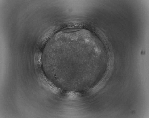 X0000115070336200911171136