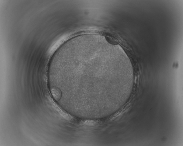 X0000115070341200911171135
