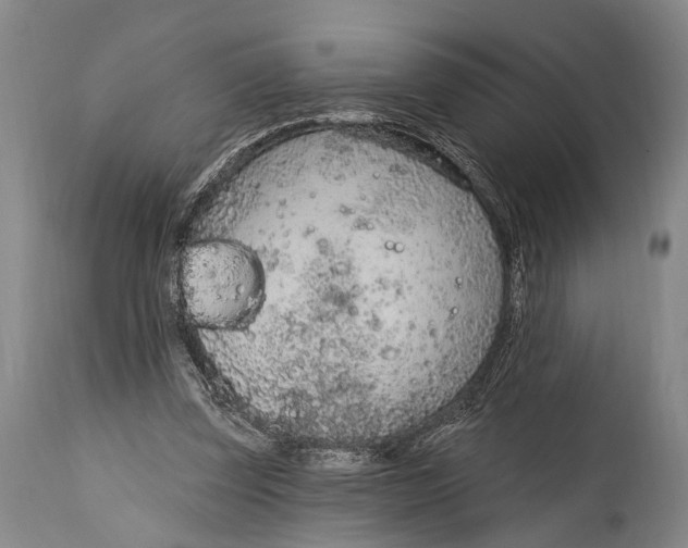 X0000115070347200911171135