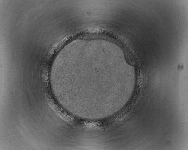 X0000115070407200911171135