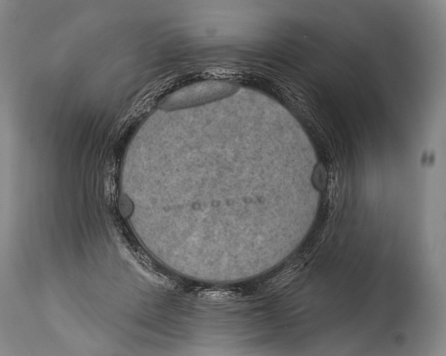 X0000115070408200911171135