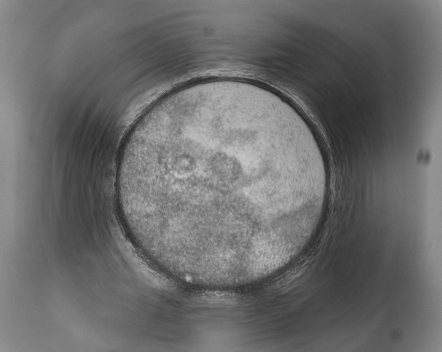X0000115070437200911171133