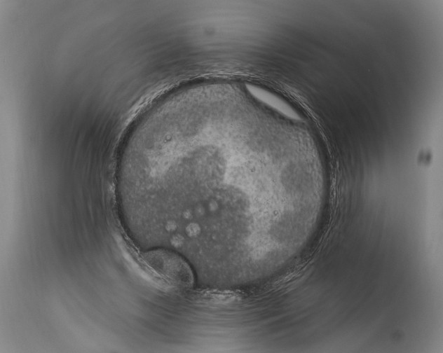 X0000115070443200911171134