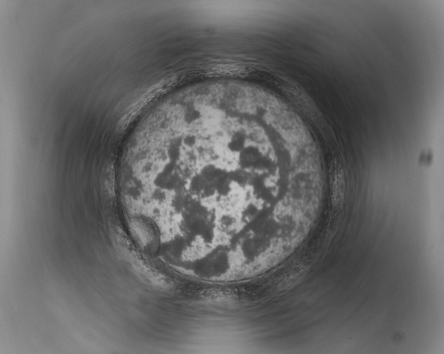 X0000115070729200911171130