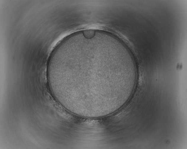 X0000115071174200911171123