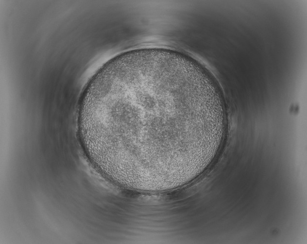 X0000115071415200911171120