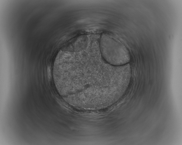 X0000115071106200911241116