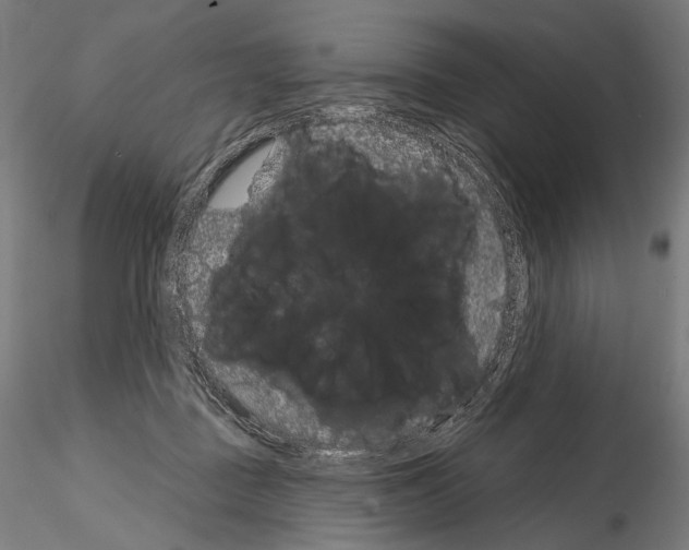 X0000115070363200912081153