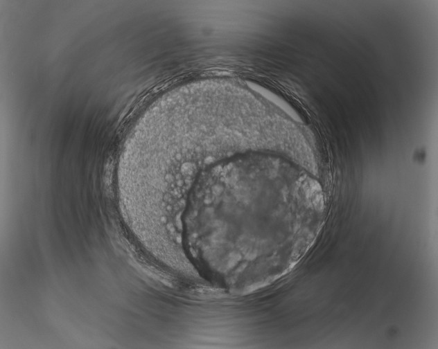 X0000115070365200912081153