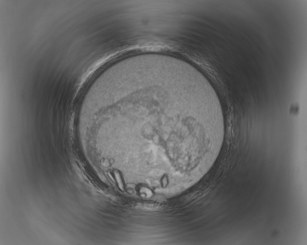 X0000115070440200912081151