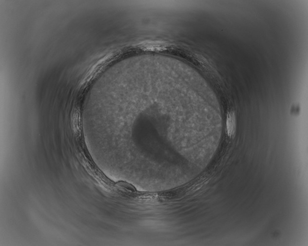 X0000115071444200912081137