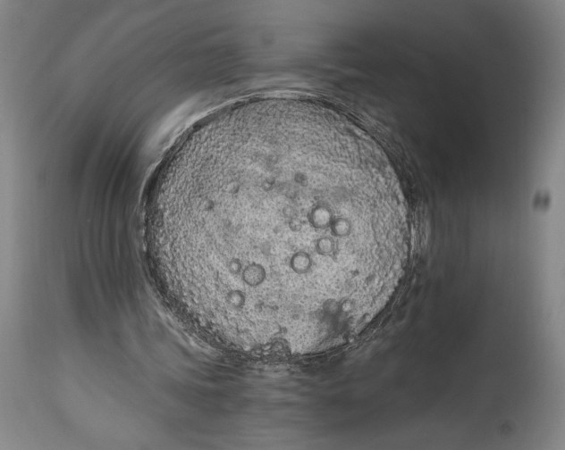 X0000115080339200911171159