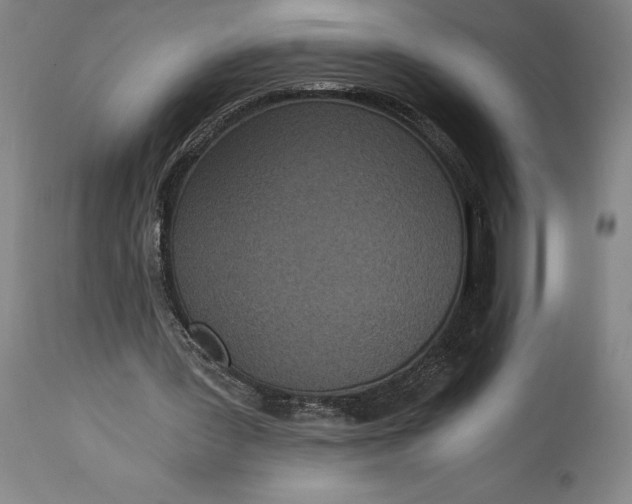 X0000115080387200911171159
