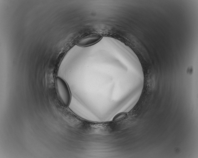 X0000115080516200911171157