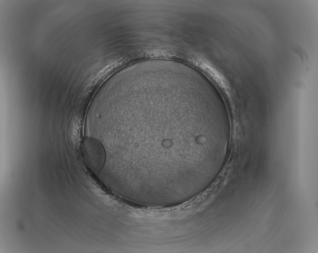 X0000115090009200911101533