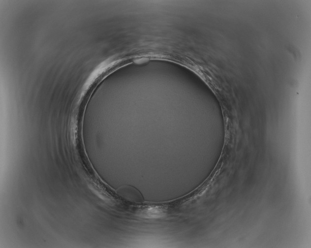 X0000115090056200911101532