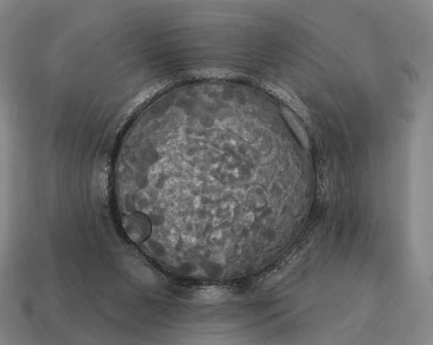 X0000115090111200911101532