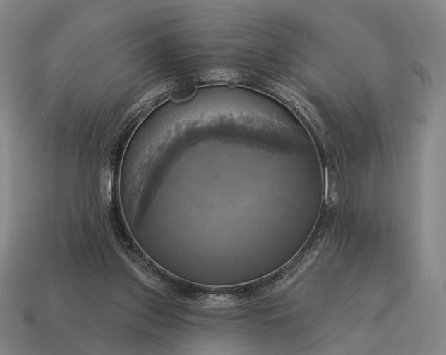 X0000115090157200911101531