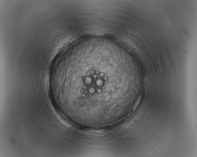 X0000115090638200911101524