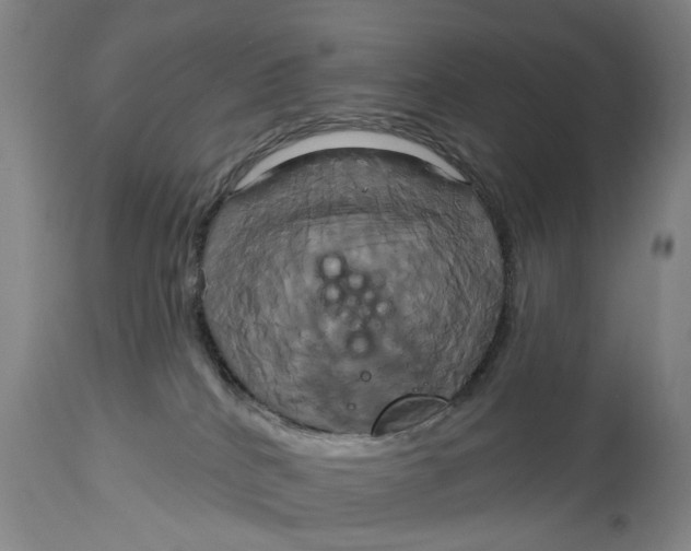 X0000115090040200911171227