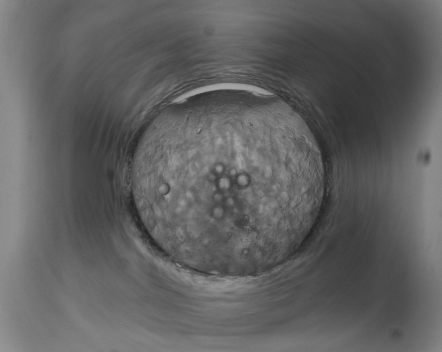 X0000115090044200911171227