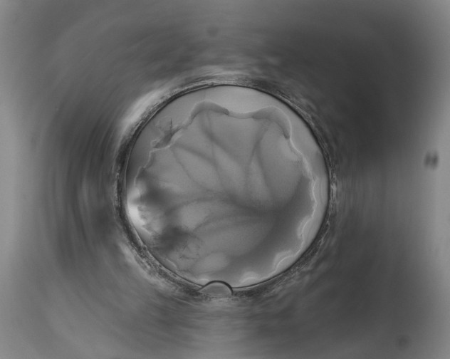 X0000115090149200911171225