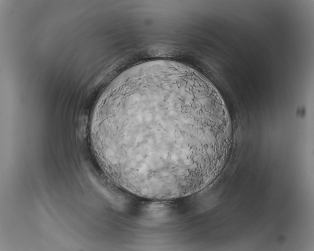 X0000115090171200911171225